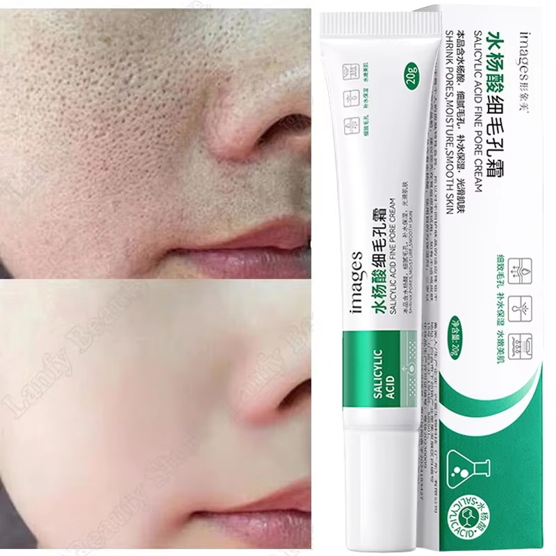 ครีมทำความสะอาดรูขุมขนกรดซาลิไ - Salicylic Acid Blackhead Remover บทวิจารณ์และราคา